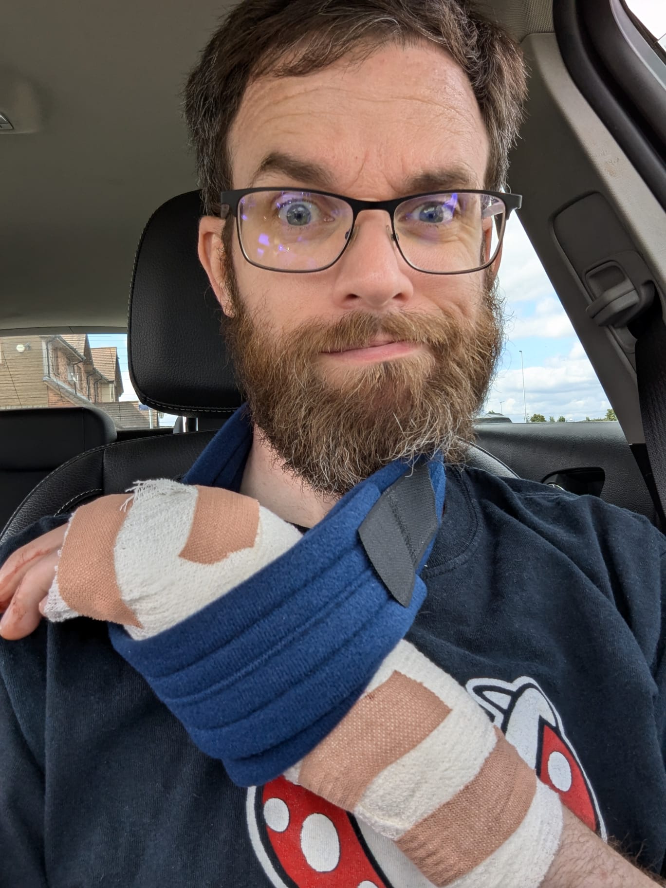 JC with a cast on an arm and bandages on hands, sitting inside a car.